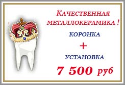 Металлокерамика. Стоматология АристократЪ-Дент